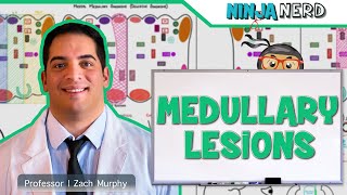 Medullary Lesions Medial and Lateral Medullary Syndromes [upl. by Aleck]