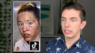 Specialist Reacts to Skin Care TikTok FAILS [upl. by Nanreit]