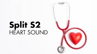 Fixed Split S2  Heart Sounds  MEDZCOOL [upl. by Lerrud]