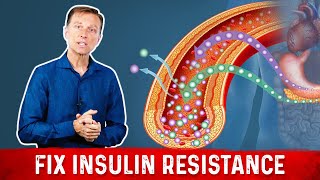 7 Things That Boost Insulin Sensitivity or Reverse Insulin Resistance  Dr Berg [upl. by Assecnirp874]