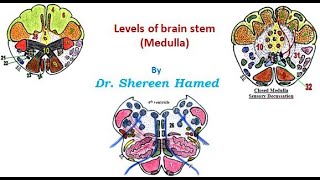 practical brain stem levels  Medulla [upl. by Jenda]