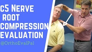 C5 Nerve Root Compression Evaluation [upl. by Otnicaj]