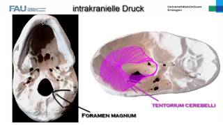 Neurologie â”€ Intrakranieller Druck [upl. by Atwekk]