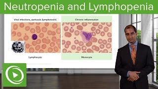 Quantitative WBC Disorders Leukocytosis amp Leukopenia – Pathology  Lecturio [upl. by Maidy202]