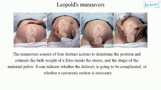 Leopolds maneuvers [upl. by Edlitam]