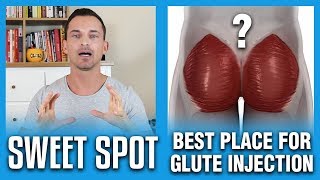 Best Place For Glute Injection  The Sweet Spot [upl. by Krucik]