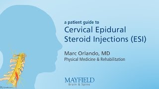 Cervical Epidural Steroid Injection [upl. by Windzer]