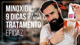 MINOXIDIL 9 DICAS para um tratamento EFICAZ [upl. by Tevis]