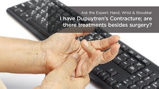 AOA Orthopedic Specialists  Dupuytrens Contracture [upl. by Ettedranreb]