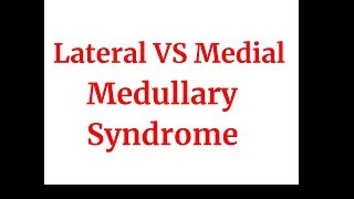 Lateral VS medial medullary syndrome [upl. by Krever9]