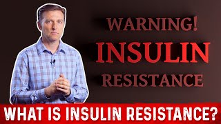 What Is Insulin Resistance – Dr Berg [upl. by Hyacinthe903]